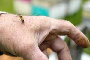 Что делать если укусила оса или пчела?